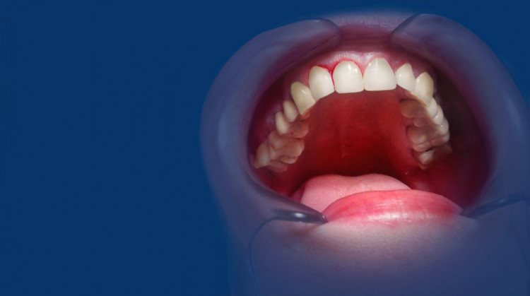 0239a17acc6ccfb83a58df76d2106dfa Как понять, когда организм просит о помощи?